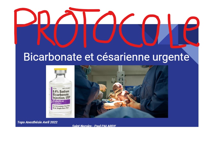Protocole bicarbonate comme adjuvant pour l’extension de l’analgésie péridurale au cours des césariennes urgentes.