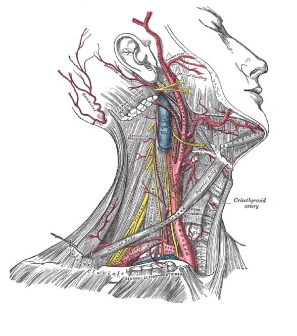 TOPO INTERNES: Anesthésie Et Chirurgie Carotidienne – Anesthésie Cité ...